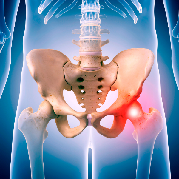 hip and groin pain